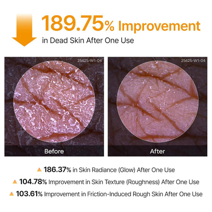 Dr. Melaxin Peel Shot Skin-Revitalising Range | Body Mist + Rice Extract Ampoule Dual-Action Set | Targets goose bumps, dullness and blackheads | Korean skincare