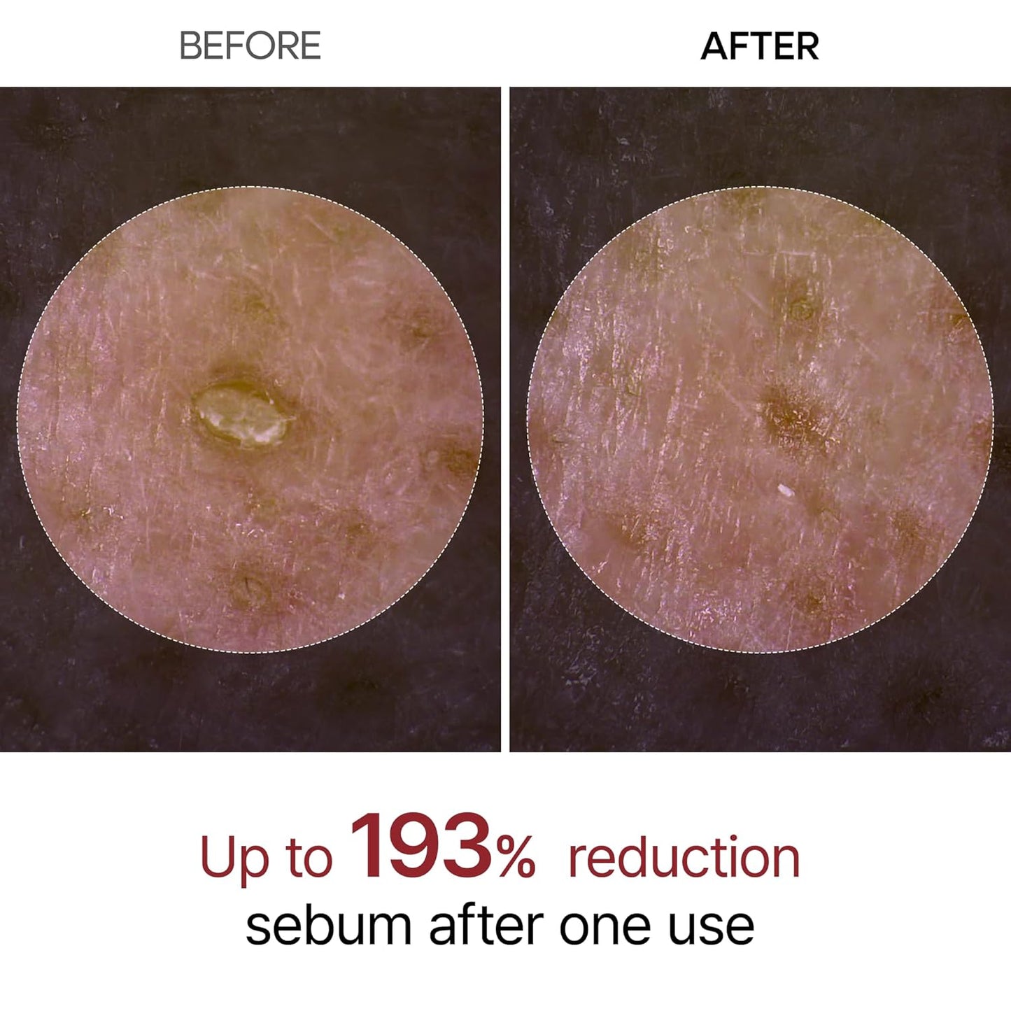 Dr. Melaxin Peel Shot Skin-Revitalising Range | Body Mist + Rice Extract Ampoule Dual-Action Set | Targets goose bumps, dullness and blackheads | Korean skincare