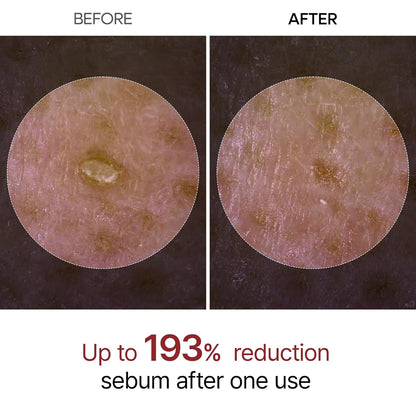 Dr. Melaxin Peel Shot Skin-Revitalising Range | Body Mist + Rice Extract Ampoule Dual-Action Set | Targets goose bumps, dullness and blackheads | Korean skincare